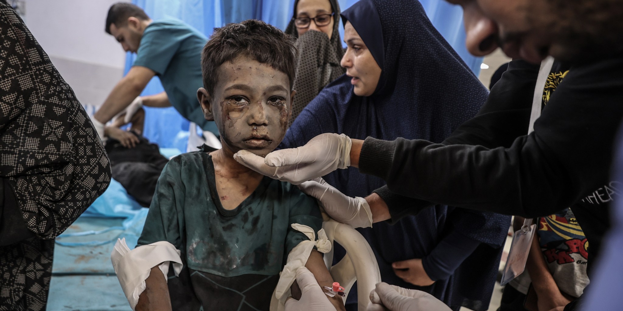 Gaza’s Hospital System on Brink of Total Collapse